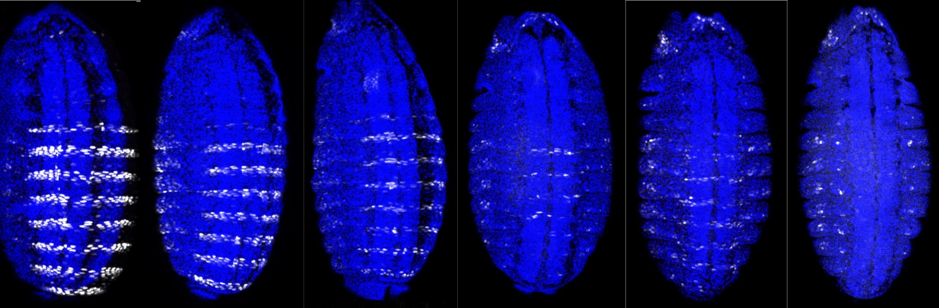 Series of embryos with Hox-Exd binding sites successively mutated in a reporter gene