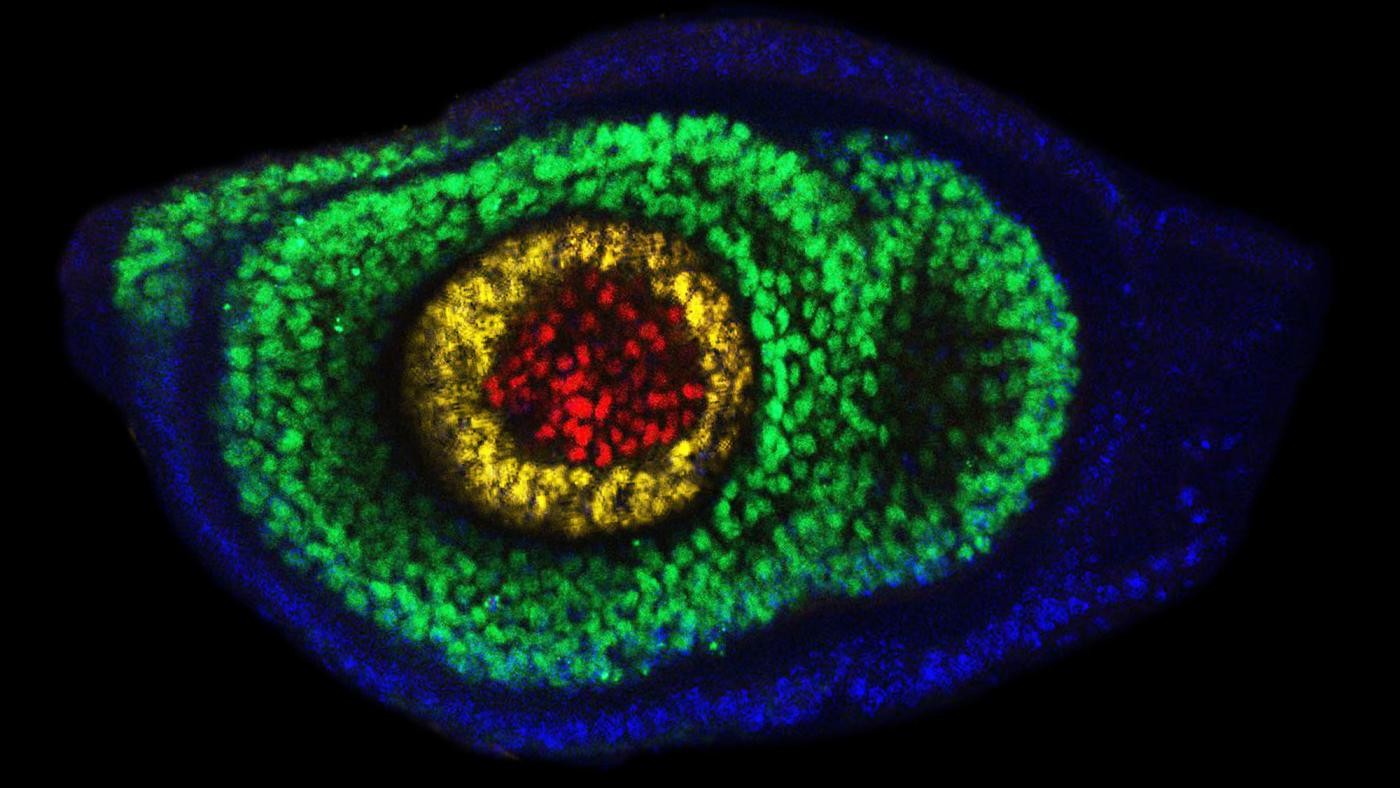 A leg imaginal disc stained for markers along the proximal-distal axis