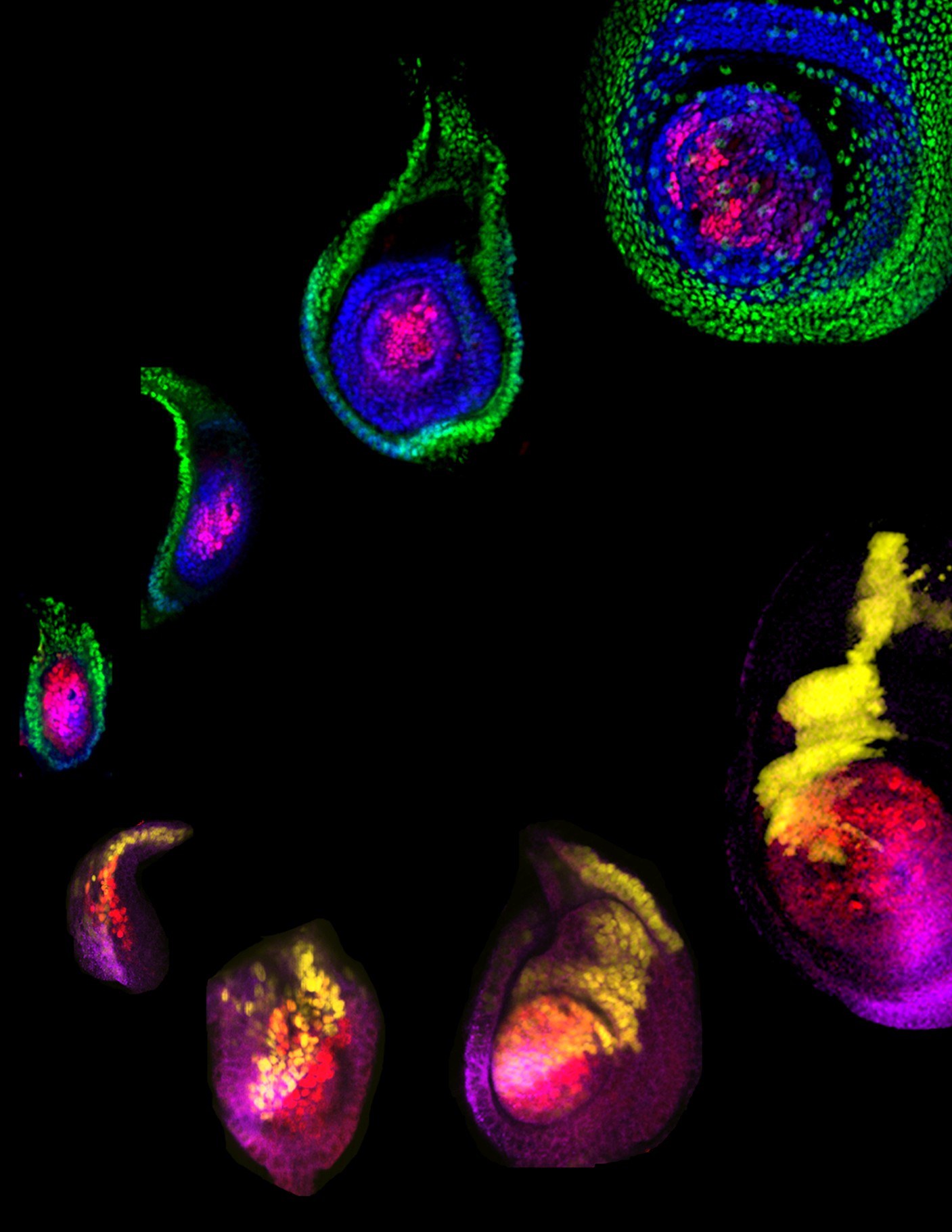 Pretty images of leg imaginal discs