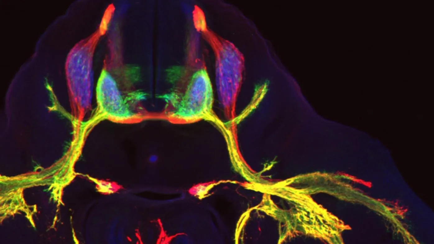 Image of labeled neurons